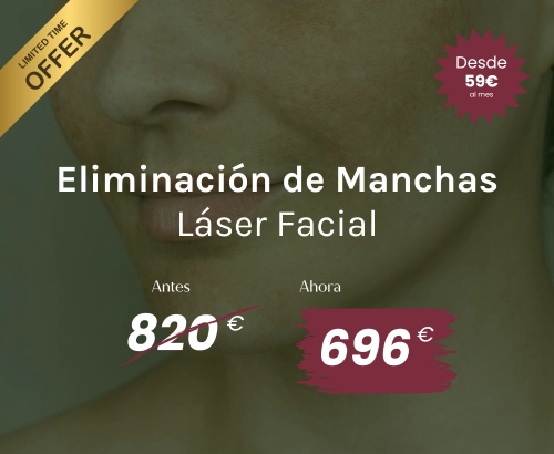 eliminar manchas iml clinic