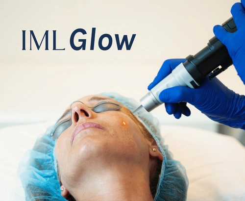 iml glow